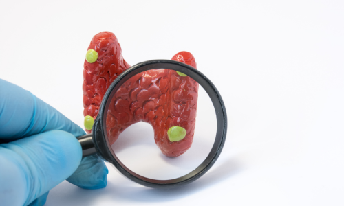 Parathyroid Problem